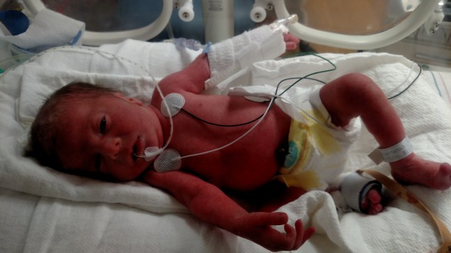 IMG_20161004_112452620